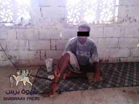 أسرة حضرمية تتوجه بمناشدة لأهل الخير من أبناء حضرموت الأكارم لمساعدتها علاج أبنها وسد حاجتها (صور)