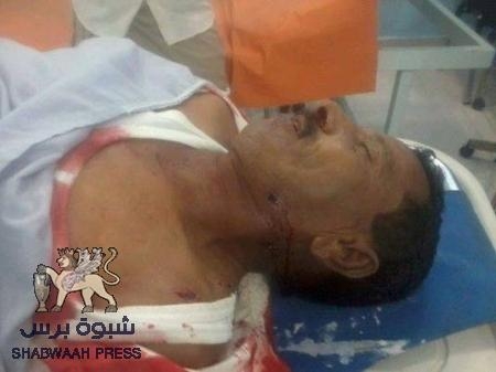 استشهاد مدير البرنامج الوطني لنزع الألغام العميد علي حسن في مدينة المكلا على يد مسلحين