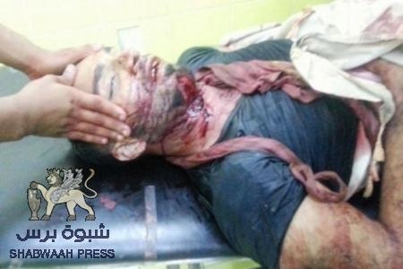 الانقلاب في صنعاء والقتل في عدن