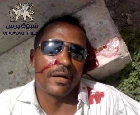 عاجل : إغتيال جندي جنوبي  في مدينة الشحر قبل قليل