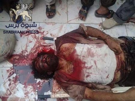 قتيلان وستة جرحى في عمليات قصف نفذتها وحدة من اللواء 33 في منطقة الضالع