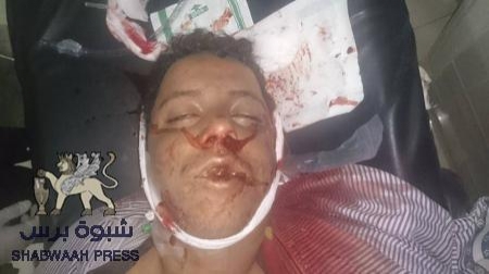 مقتل أحد معتصمي أنصار الله في عملية الاقتحام