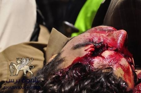 سقوط قتلى في أحداث صنعاء تطيح بمدير شرطتها وتعيين بديلا عنه (صور)