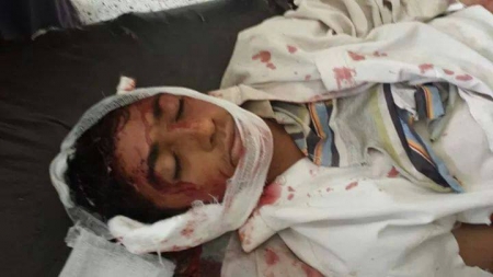 مقتل 36 شخصا وجرح العشرات جراء اتساع المعارك بين الحوثيين والاخوان وبن عمر يؤكد استمرار المفاوضات
