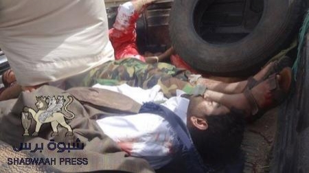 43 قتيلا وأكثر من 150 جريحا نتيجة التفجير الإرهابي في تحرير صنعاء والعدد قابل للزيادة (صور)