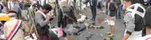 وزارة الصحة اليمنية : 47 شهيدا و 75 جريحا جراء التفجير الانتحاري بميدان التحرير بالعاصمة صنعاء