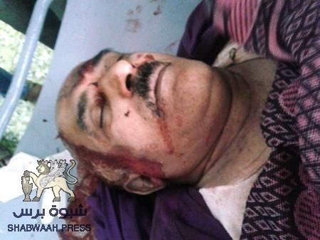 كانوا ضمن مواكب الزاحفين من ابناء الضالع صوب عدن .. وفاة شخص ونجله من الشعيب في حادث مروري مروع بالعند