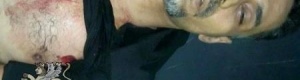 عاجل : استشهاد الناشط خالد الجنيدي برصاص جنود الاحتلال اليمني