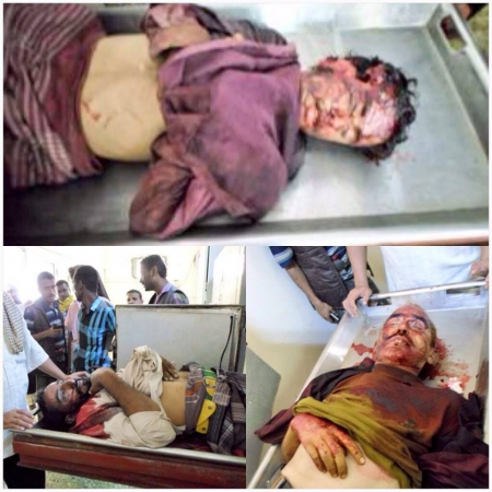 بلاغ صحفي عن الحراك الثوري يكشف عن سقوط ثلاثة شهداء بردفان أثر قصف الجيش للمنازل والمواطنين .