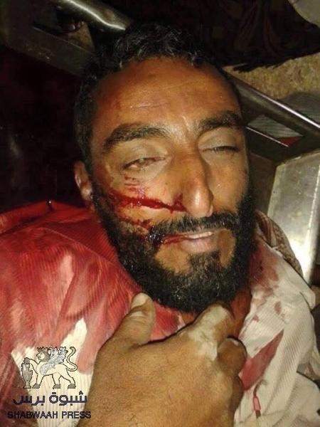 بيان هام صادر عن الهيئة الوطنية الجنوبية المؤقتة للتحرير والاستقلال حول الأعمال الاجرامية في ردفان