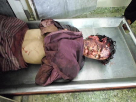 بيان صادر عن مجلس الحراك الثوري مديريه الحبيلين يدين تصريحات قائد محور العند واللواء 201 مرزوق الصيادي