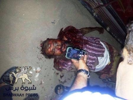 أول إغتيال يطال شيخ سلفي في محافظة لحج (صور)