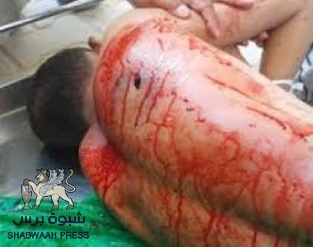 عاجل : إغتيال المواطن علوي السقاف من أبناء حوطة لحج