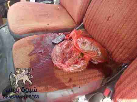 مجهولون يقتلون سائق حافلة ركاب صغيرة في عدن (صور)