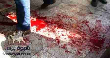 عاجل الان : مصرع شاب بمحجفة لحج وذبح اخر في الضالع