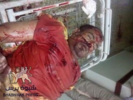 عاجل : مقتل ثلاثة جنود من حراسة مكتب بريد حوطة لحج (صور)