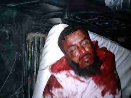 مقتل احد ابناء الصبيحة الان في اشتباكات مع موكب العميد عبدا لحافظ السقاف