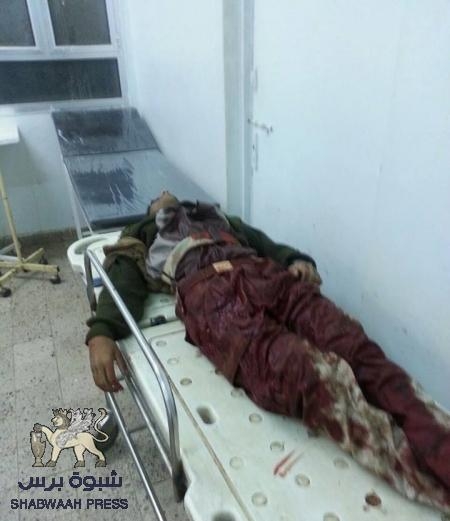 عاجل: المقاومة الجنوبية تخوض قتال في شوارع عتق ومقتل حوثيين (صور)
