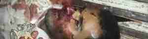 مقتل جنديا استطلاع يمنيان في نقطة النقبة بشبوه (صور)