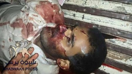 مقتل جنديا استطلاع يمنيان في نقطة النقبة بشبوه (صور)