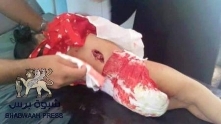 دعوة الى تدخل بري في عدن لقوات دولية  بدعم من قوات التحالف
