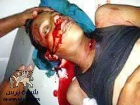 أول شهيد للهدنة طفل في الرابعة عشر من عمره بمديرية الضالع