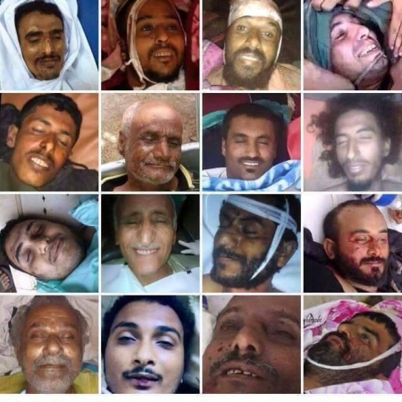 800 شهيد و6300 جريح ضحايا الميليشيات بالجنوب
