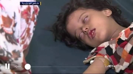 وفاة قرابة الـ (600) في عدن بالضنك وحضرموت (9) حالات والمجاعة تهدد الجنوب .