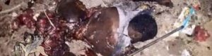 عشرات من القتلى والجرحى في مذبحة قوات الاحتلال اليمني لمنصورة عدن (صور بشعة)