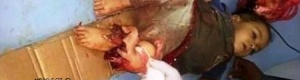 في آخر إحصائية:31 شهيدا و103جريحا من النساء والأطفال النازحين من منازلهم في عدن (صور)