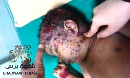 دور رئيسي لحزب الاصلاح بالجرائم التي ترتكب من قبل الحوثيين بحق الجنوبيين