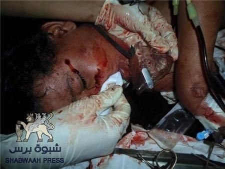 أستياء من برنامج بتلفزيون عدن الحكومي لأهانة أسر الشهداء (بقطمة أرز)
