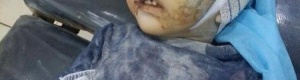 18 شهيد و117 جريح ضحايا مجزرة 7-7 للحوثيين بمنصورة عدن (صور)
