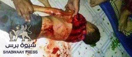 الضالع تقدم أول شهيد بعد إعلان الهدنة نتيجة عدم التزام الحوثيين بها