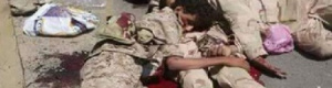وصلت من محافظات الجنوب : أكثر من 100 جثة لمسلحي الحوثي تتكدس في مستشفى ذمار العام