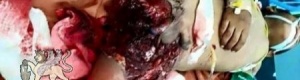 قوات عفاش والحوثيين ترتكب مجزرة بحق المدنيين في دار سعد