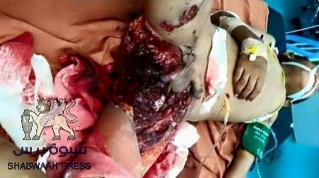 قوات عفاش والحوثيين ترتكب مجزرة بحق المدنيين في دار سعد