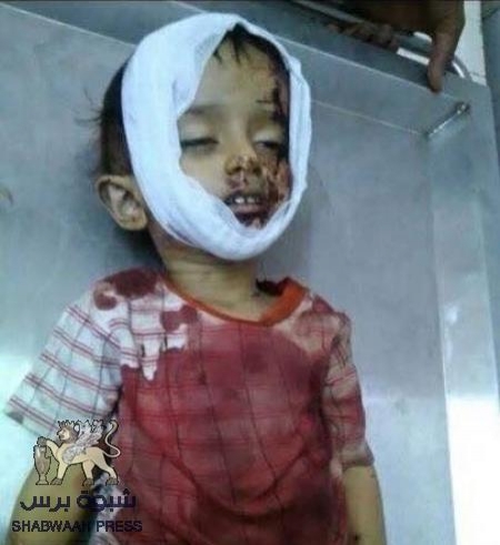 مؤسسة صح لحقوق الانسان تدين مجازر ميليشيات الحوثي وصالح في عدن وتدعو لتدخل المجتمع الدولي