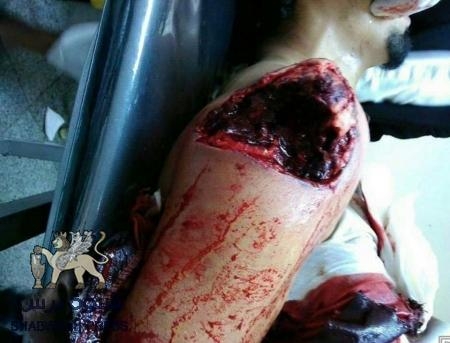 طيران اليمنية والسفارة في الخرطوم يخططون لأهداء جرحى المقاومة الجنوبية للحوثيين