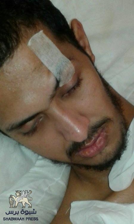 وزير الصحة اليمني يتجاهل الجريح ‘‘شوقي فهمي احمد مسعد‘‘ أثناء زياراته للأردن
