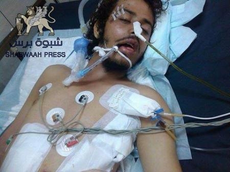مأساة جريح جنوبي في سلطنة عمان يحتاج العون لإكمال علاجه في الهند(صورة تقرير)