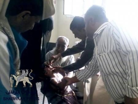 المقاومة الجنوبية تدشن حملة تحصين الاطفال بالمحفد.