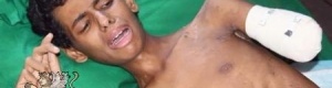 العوادي ينقض إتفاقا عقده شلال مع بحاح لصالح علاج جرحى المقاومة