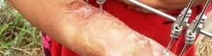 مناشدة لأهل الخير وأصحاب القلوب الرحيمة ( أنقذوا الطفلة آيات )