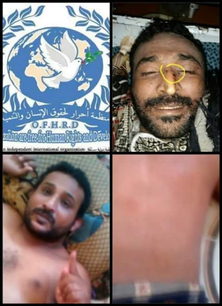 بيان صادر عن منظمة أحرار الدولية لحقوق الإنسان والتنمية