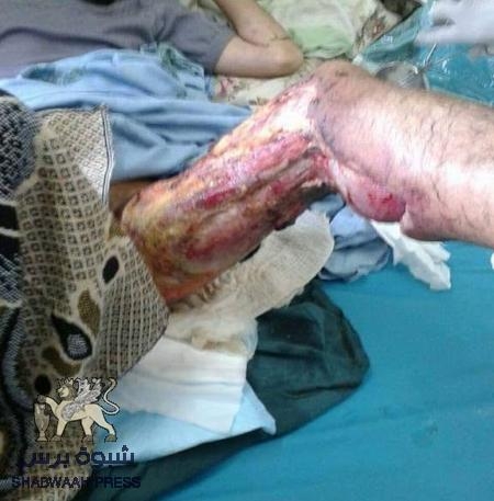 عام على مجازر عدن.. القاتل طليقاً