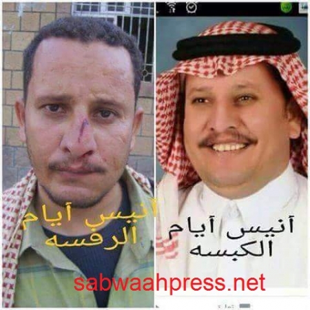 اعلاميو ووسائل اعلام الاصلاح يساندون الحوثيين علنا