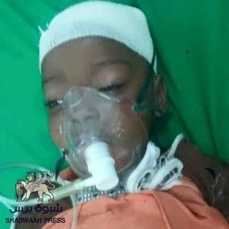 طفلة المكلا &lsquo;&lsquo;منار&lsquo;&lsquo;: قتلها رصاص الأعراس الراجع