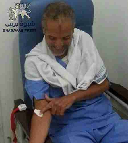 إدارة السجن المركزي بصنعاء ترفض إبقاء الأسير المرقشي بالمستشفى