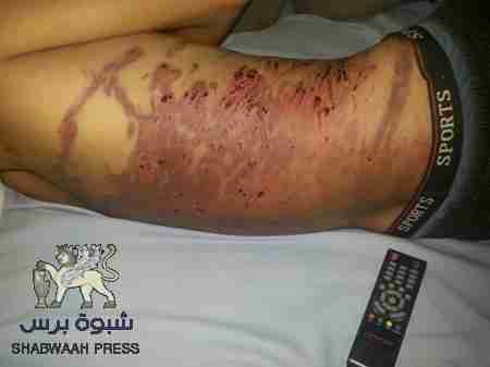 محافظ العاصمة عدن يوجه بالتحقيق بشأن حادثة التعذيب للشاب علي باسل عمر